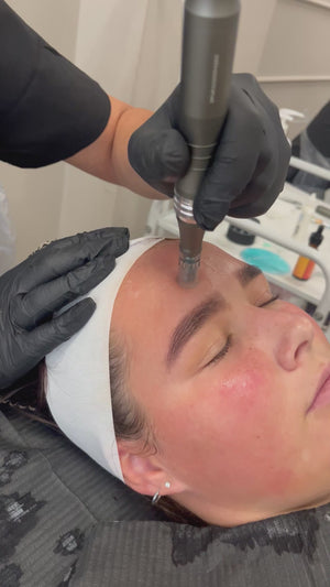 Micro-needling Course